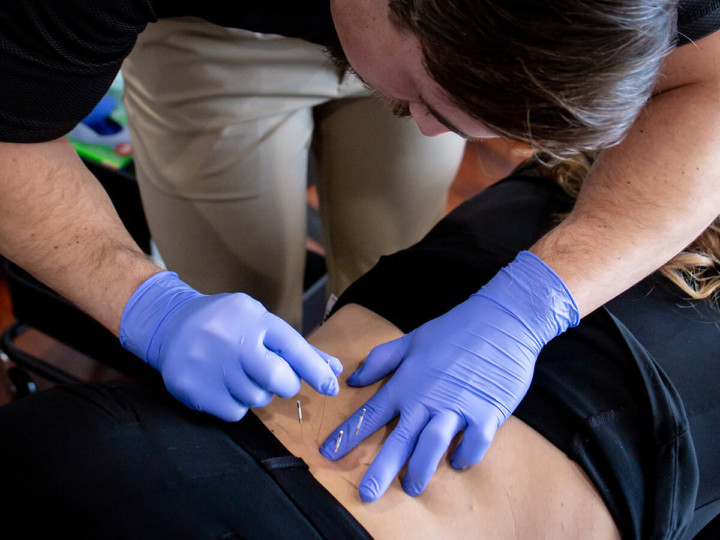 Dry Needling, Downtown Miami