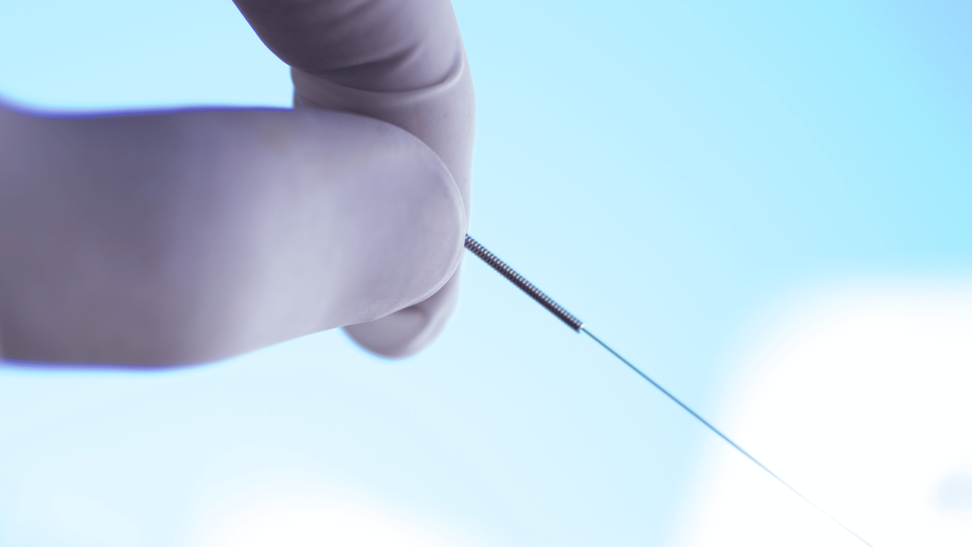 What is Functional Dry Needling? - Comprehensive Chiropractic